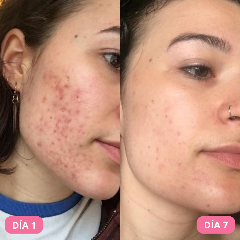 Eternal 345® Crema Reparadora y Cicatrizante