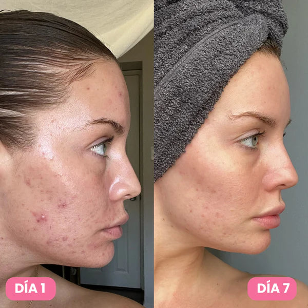 Eternal 345® Crema Reparadora y Cicatrizante