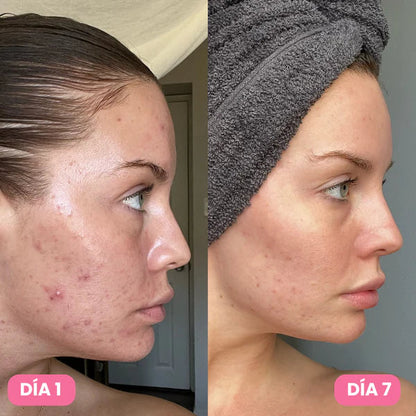 Eternal 345® Crema Reparadora y Cicatrizante