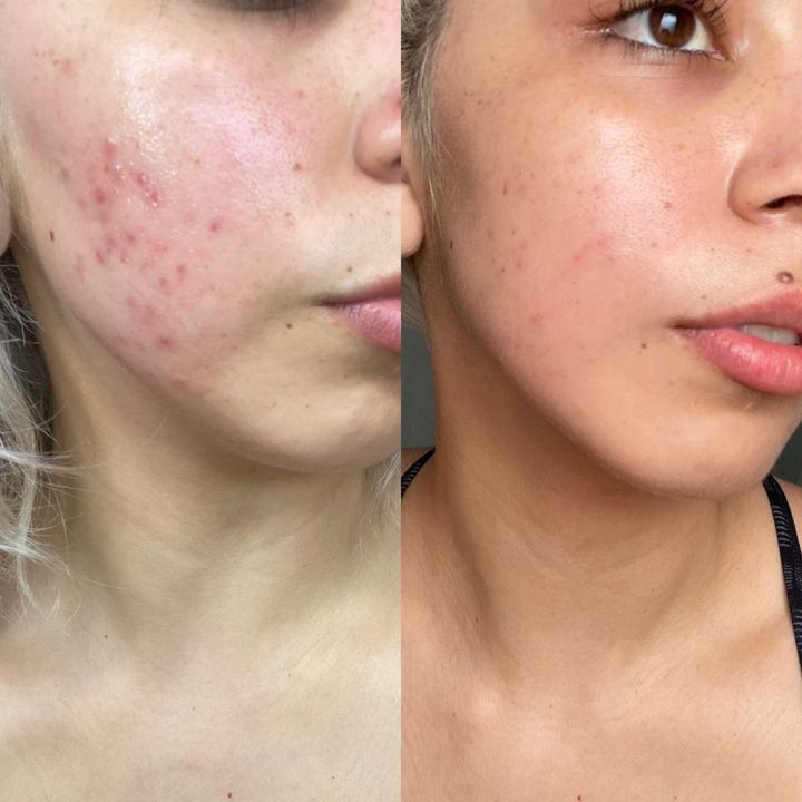 Eternal 345® Crema Reparadora y Cicatrizante