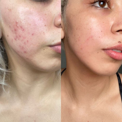 Eternal 345® Crema Reparadora y Cicatrizante